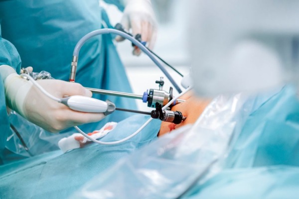 How to Choose the Best Gastric Bypass Surgeon for Treatment