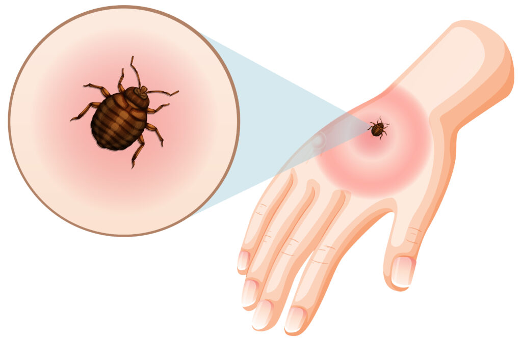 Biomagnetism for Lyme Disease: What You Need to Know