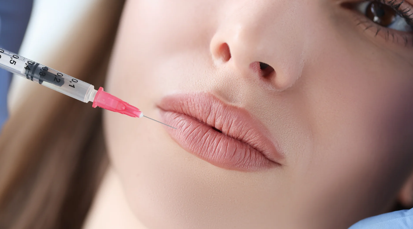 Understanding Russian Lip Fillers Scarring Insights From Best Aesthetics Clinic in Dubai