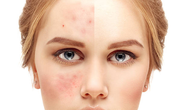 Best Skin Specialist: Expert Dermatologists for Healthy Skin