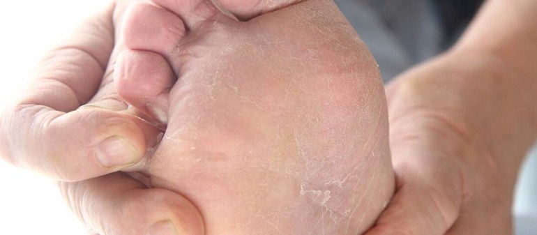 The Ultimate Guide to Finding the Right Athlete’s Foot Docto