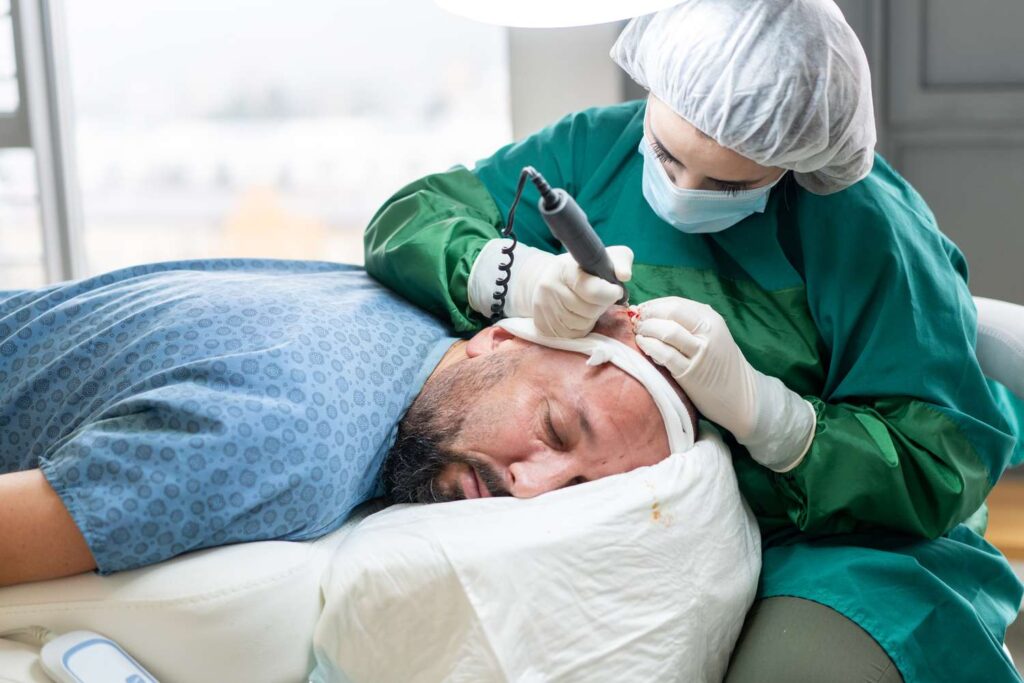 Top UK Clinics for a Fuller, Natural Hair Transplant Look