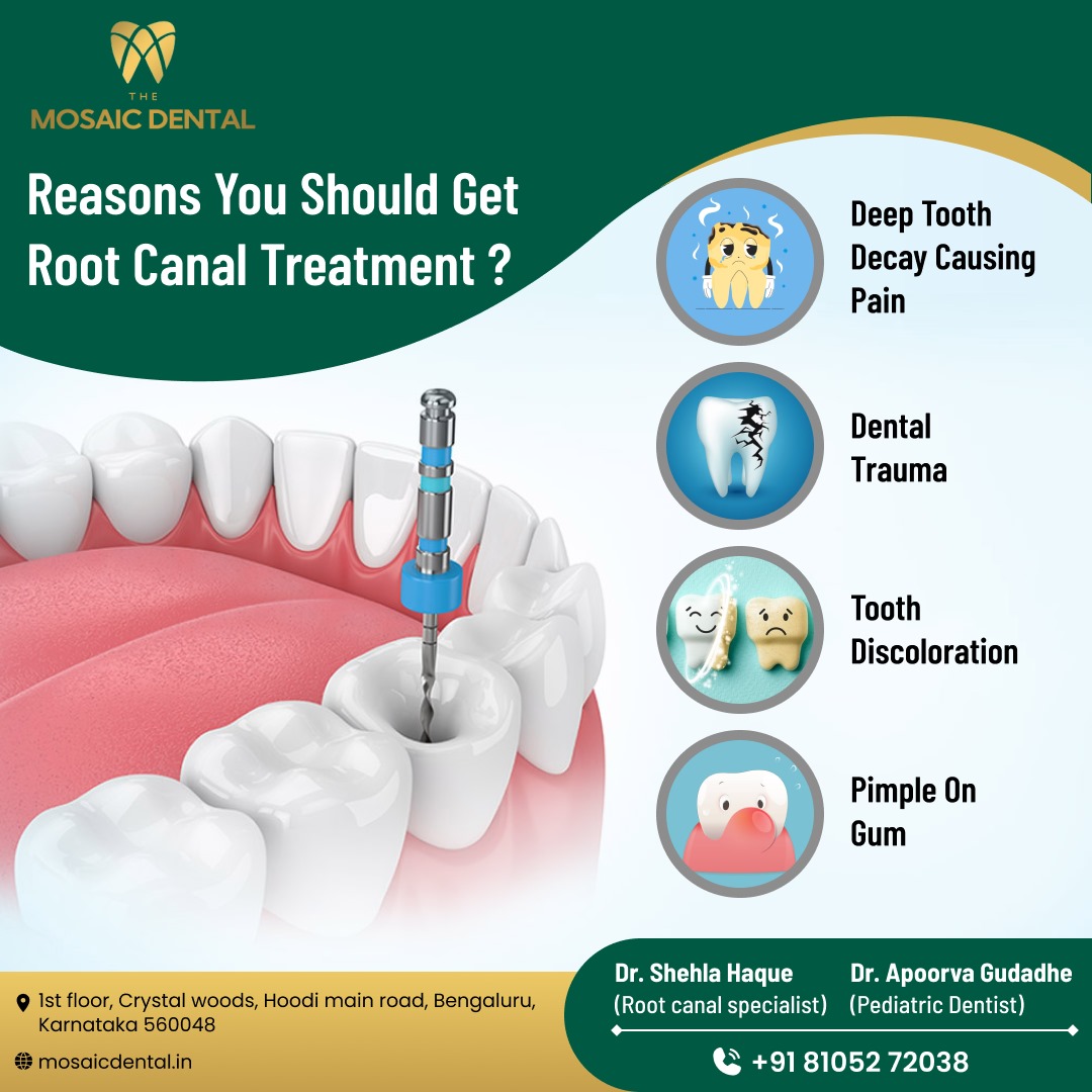 Choose the Best Root Canal Treatment in Bangalore