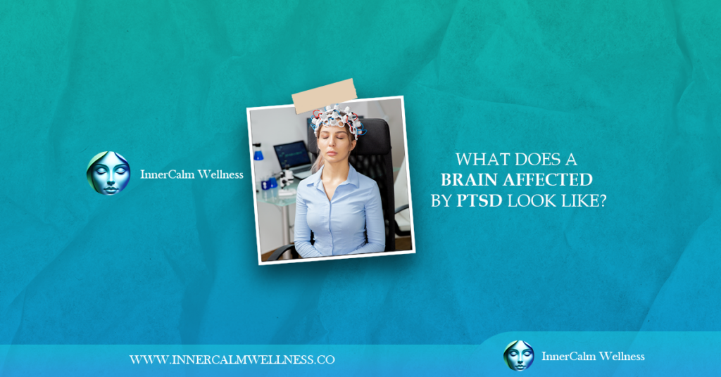 What Are Some Common Sleep Disorders?