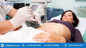 United States Biopsy Market Analysis Size And Forecast Repor