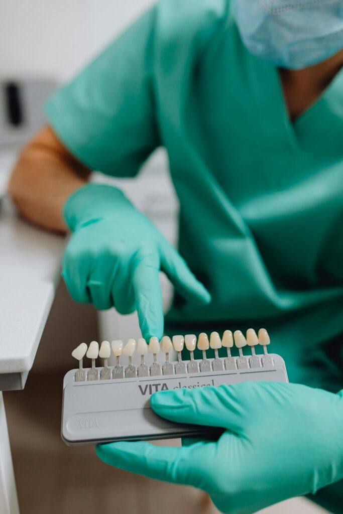 The Benefits of Choosing Veneers for Your Smile Makeover