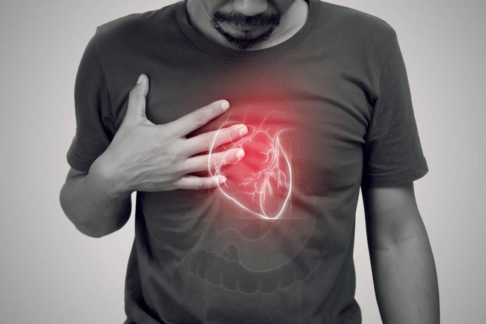 Five Surprising Aspects of Heart Failure