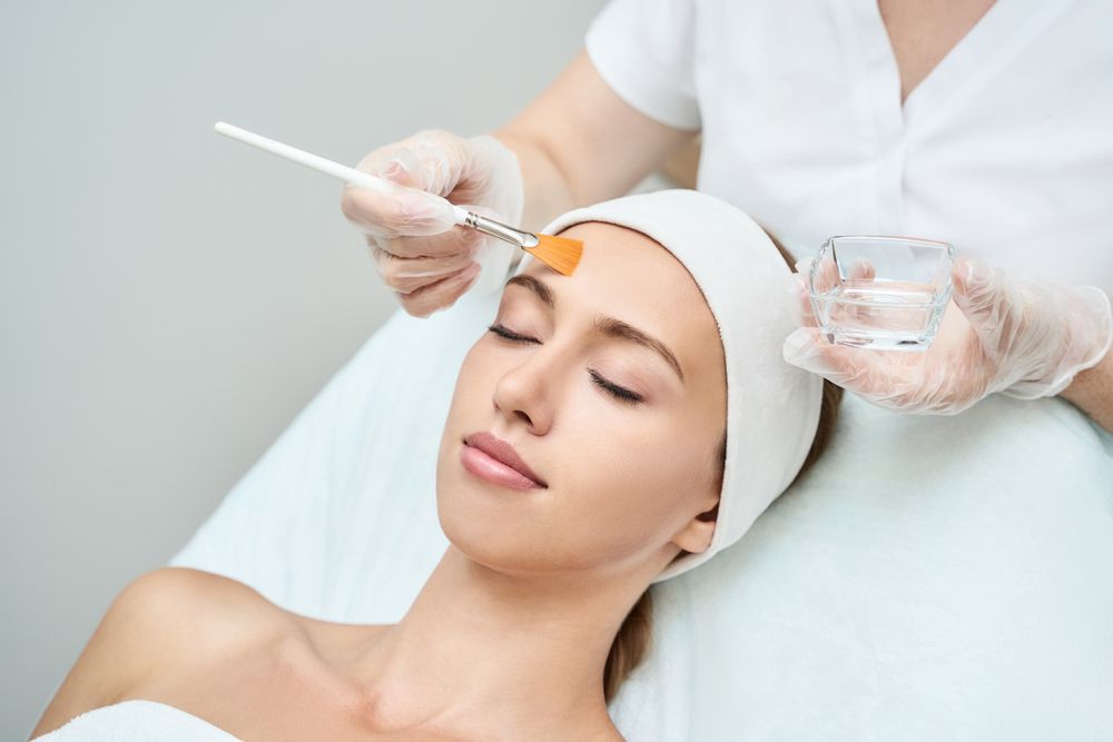 Transform Your Skin with Expert Chemical Peel for Melasma