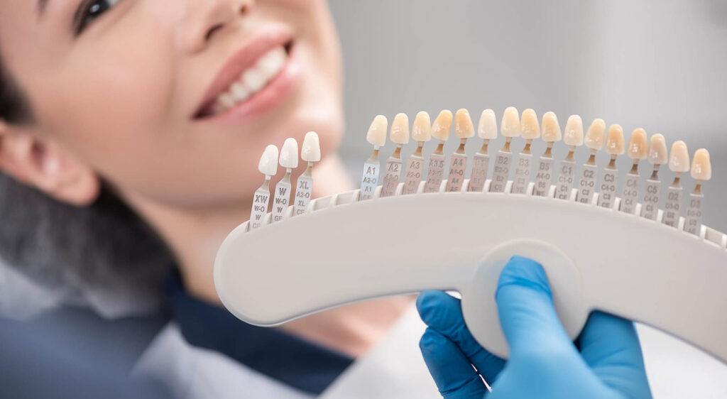The Importance of Shade Selection for Dental Veneers
