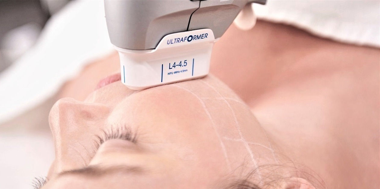 HIFU Treatment: The Secret to Youthful Skin Without Surgery