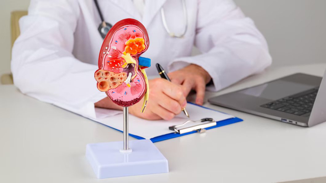 Kidney Specialist in Dwarka: Expert Care for Your Renal Heal