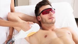 Male Laser Hair Removal: The Ultimate Guide to Smooth Skin
