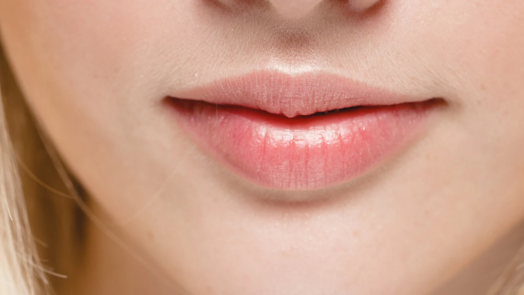 The Facts Behind Laser-Treated Lips and Their Lasting Color