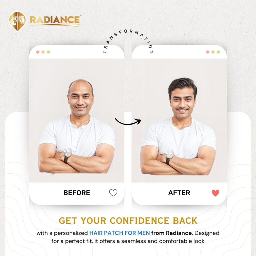 Hair Patch for Men: The Ultimate Solution for Hair Loss