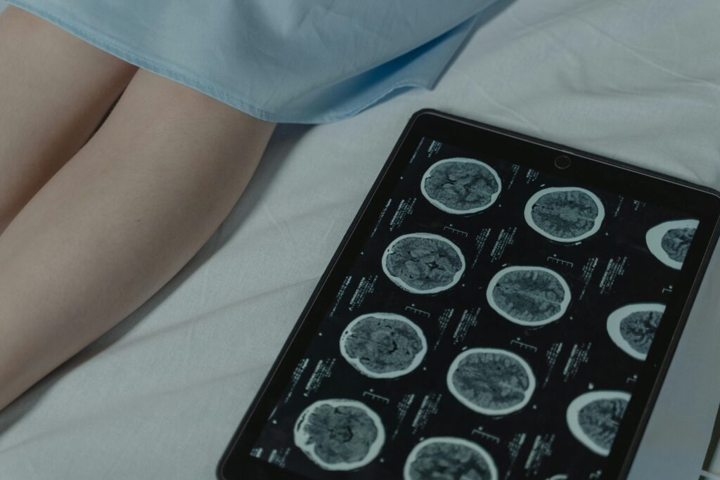 The Power of Peptides for Brain Health and Memory