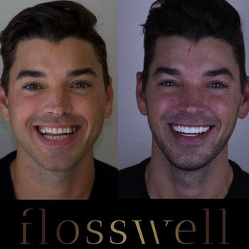 Cosmetic Dentistry vs. Restorative Dentistry: What’s the Dif