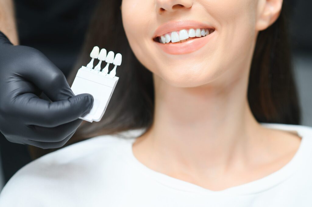 Dental Veneers: The Key to Achieving Your Ideal Smile