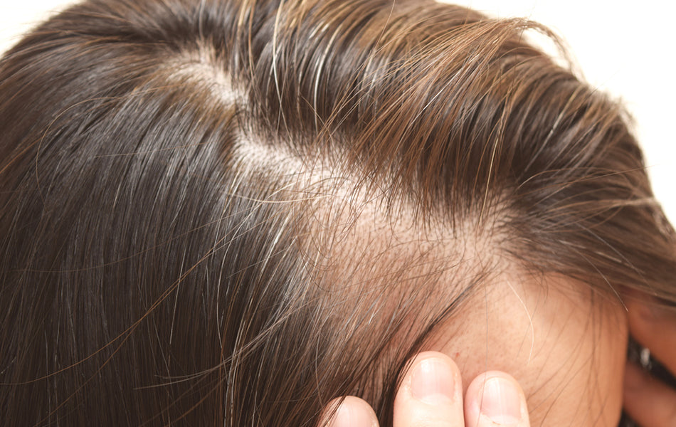Can Finasteride Cause Erectile Dysfunction?