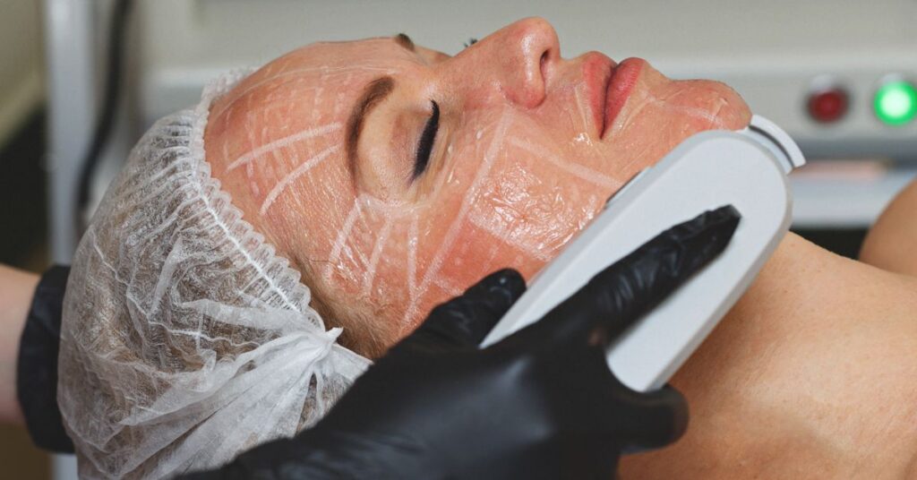 HIFU for Chin & Brow Lift: Get a Tighter, More Defined Face