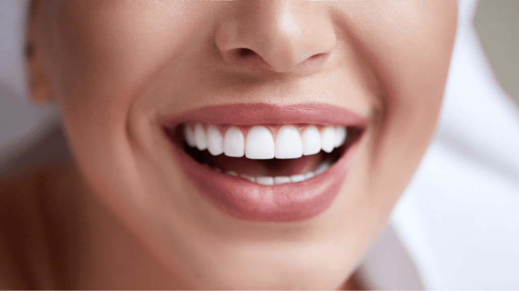 How Much Does Invisalign Cost for Teenagers?