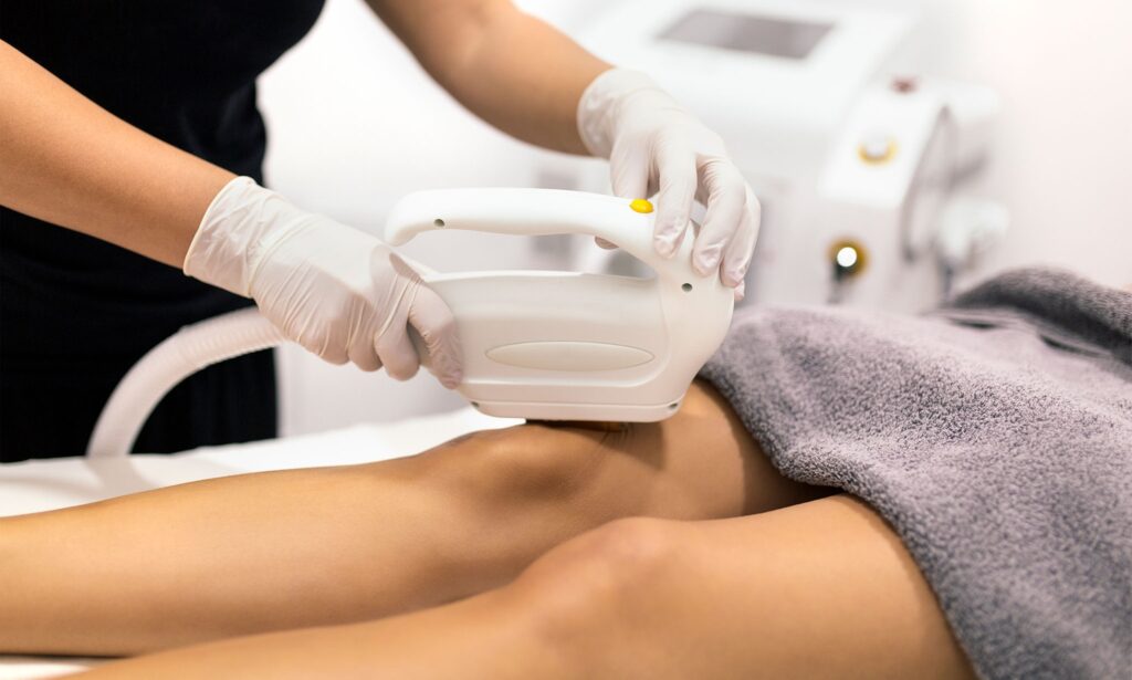 Laser Hair Removal: Gentle, Painless & Super Effective!