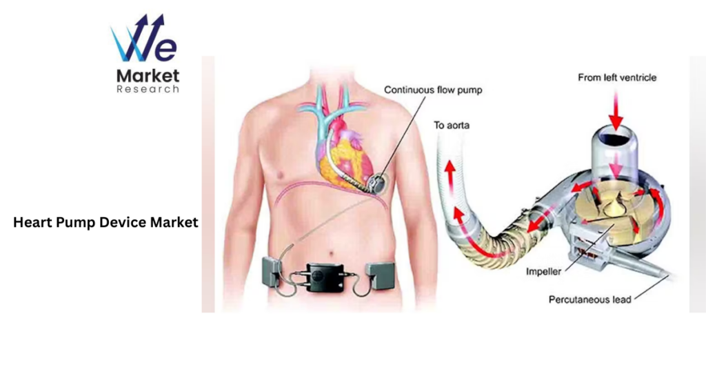 Heart Pump Device Market, Heart Pump Device Market Forecast,