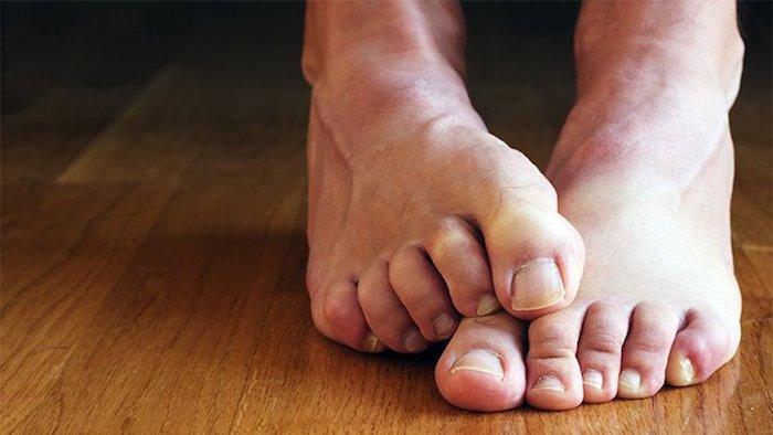 Diabetic Foot Care at Home in Dubai Matters More Than Ever