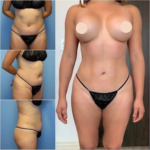 How to Find the Best Body Contouring Surgeon in dubai