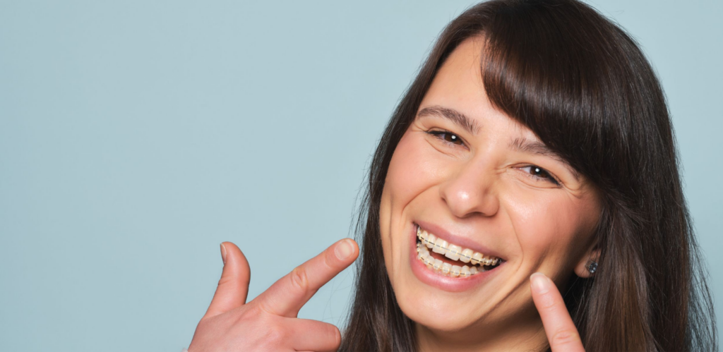 What Foods Should You Avoid While Wearing Braces?