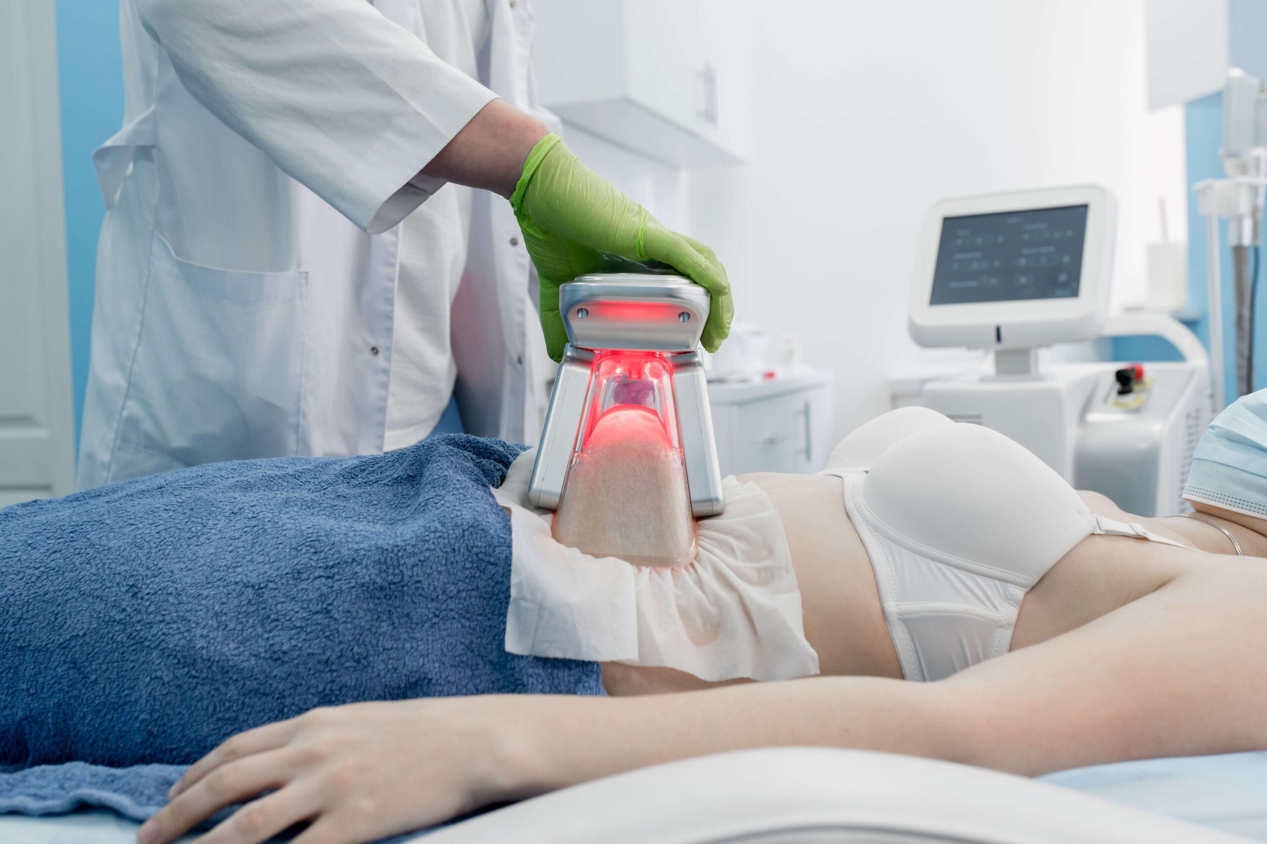 CoolSculpting Treatment Areas Explained