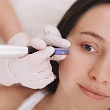 Plasma Pen for Wrinkles: Top Anti-Aging Solution Reviewed