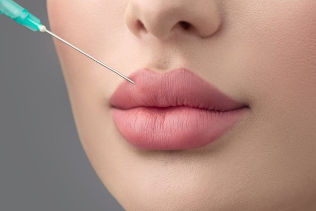 Latest Trends in Russian Lip Fillers in Dubai