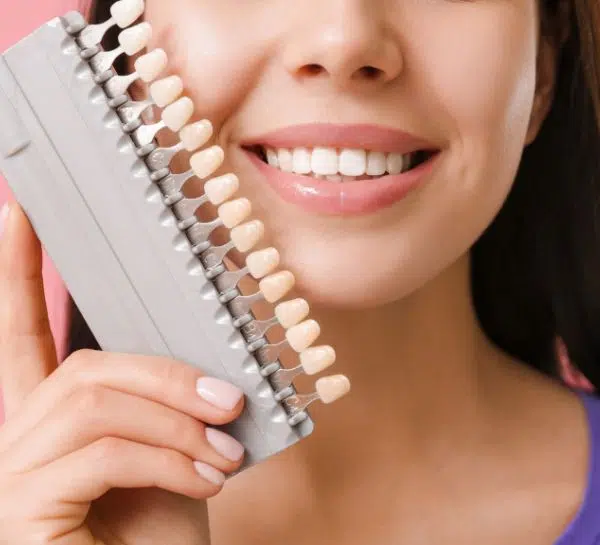The Benefits of Thin-Shell Dental Veneers