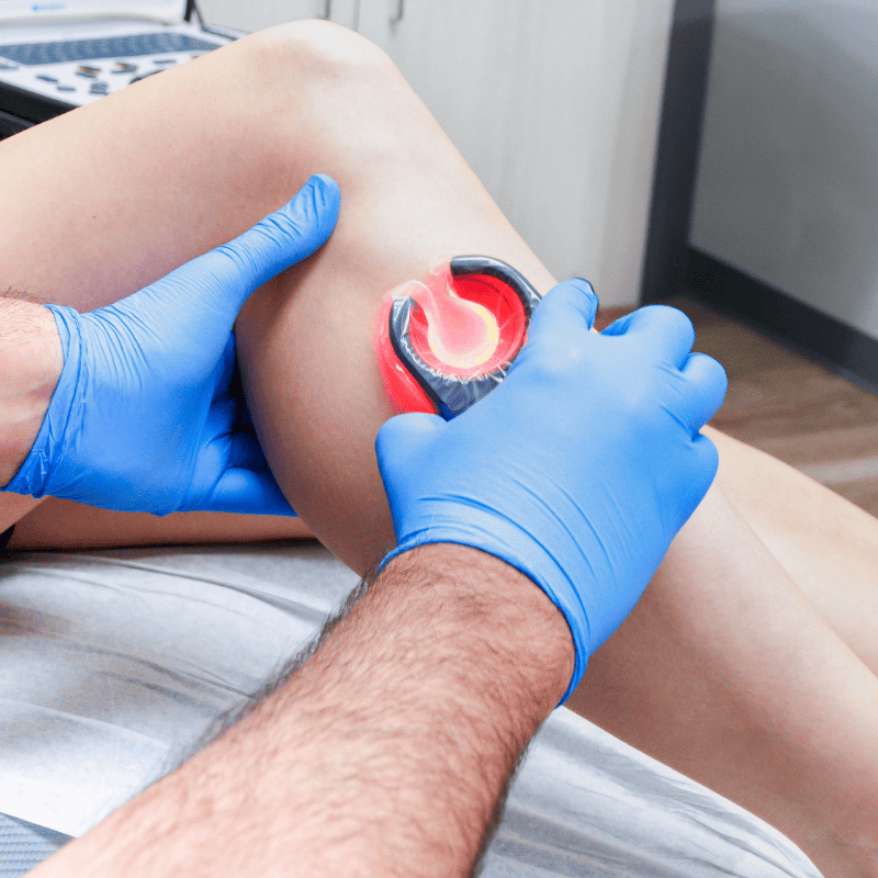 Which Medical Professionals Can Help with Varicose Veins?