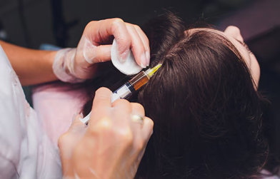 Cost of PRP Hair Treatment in Bangalore