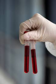Blood Test at Home Ghaziabad: Convenient and Reliable