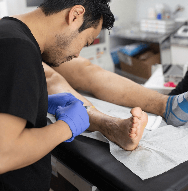 What Are the Latest Advances in Varicose Vein Treatment?